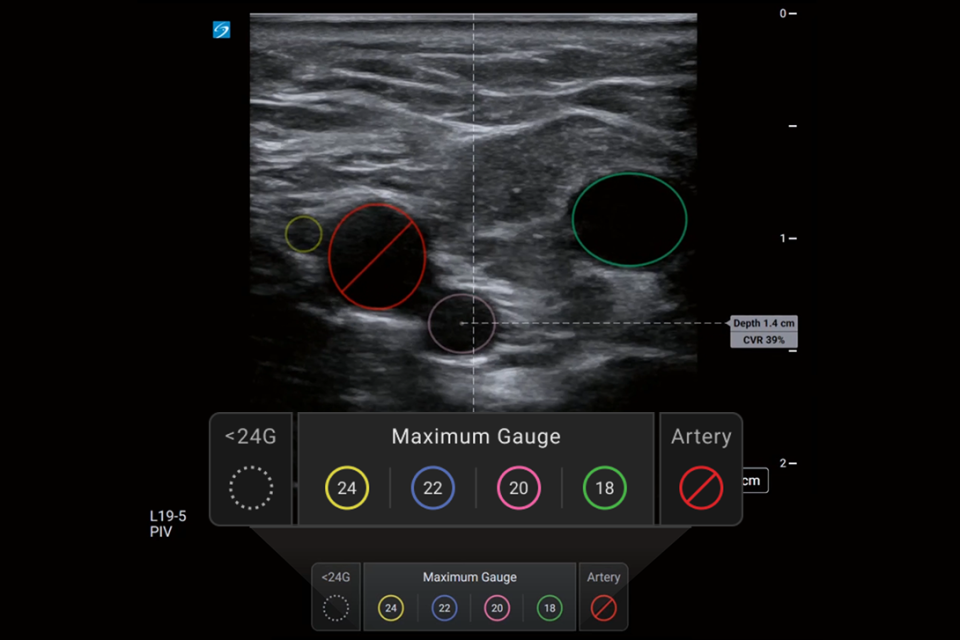 Máquinas de ultrassom portáteis | FUJIFILM Sonosite